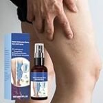 Los mejores aceites para tratar varices en los brazos: análisis y comparación